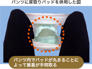 パンツに尿取りパッドを併用した図／パンツ内でパッドが丸まることによって装着が手間取る